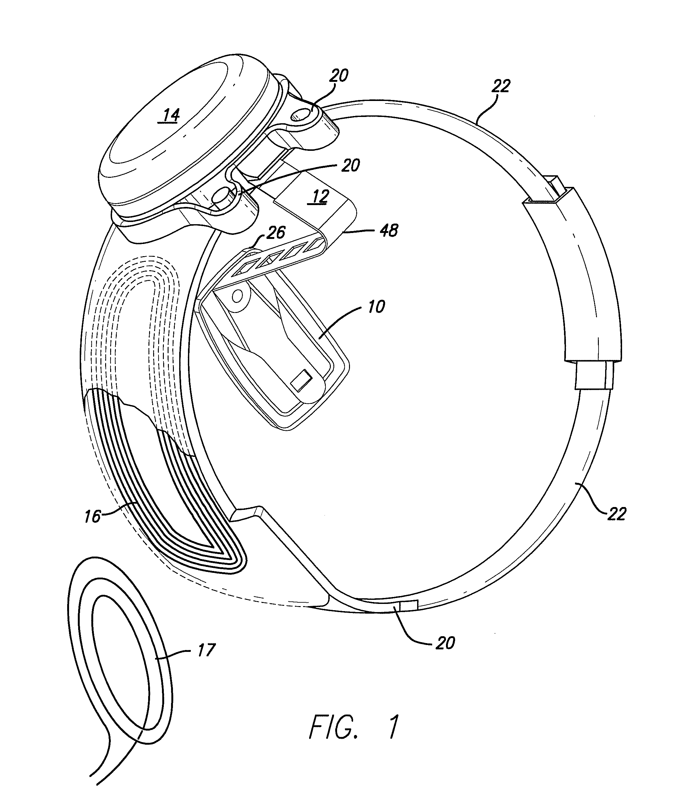 Visual Prosthesis with an Improved Electrode Array Adapted for Foveal Stimulation