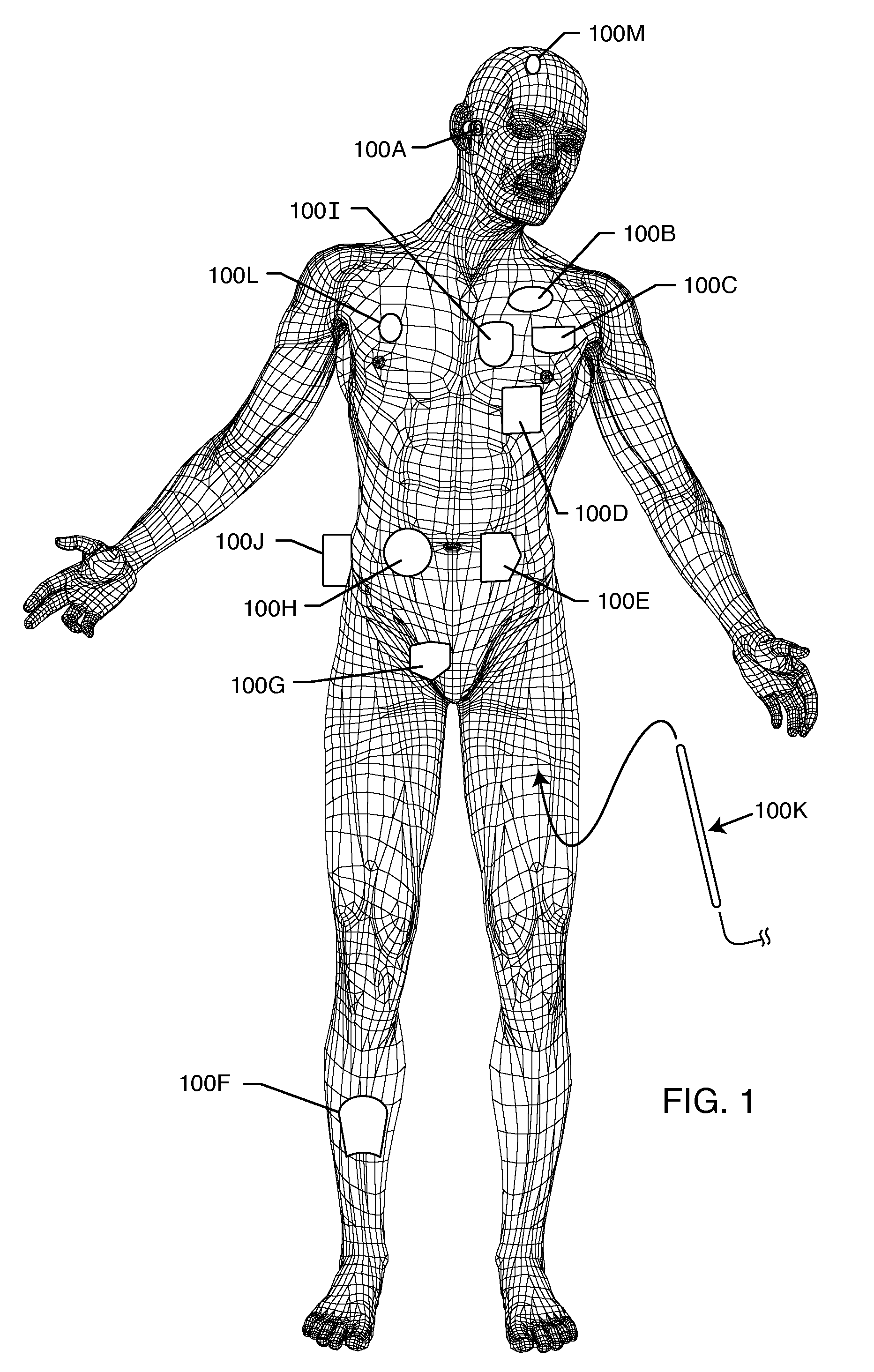 Tank filters adaptable for placement with a guide wire, in series with the lead wires or circuits of active medical devices to enhance MRI compatibility