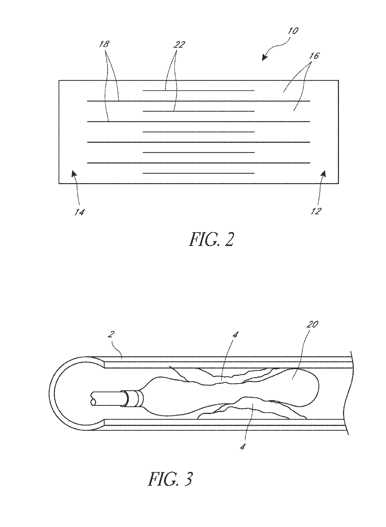 Cage for medical balloon