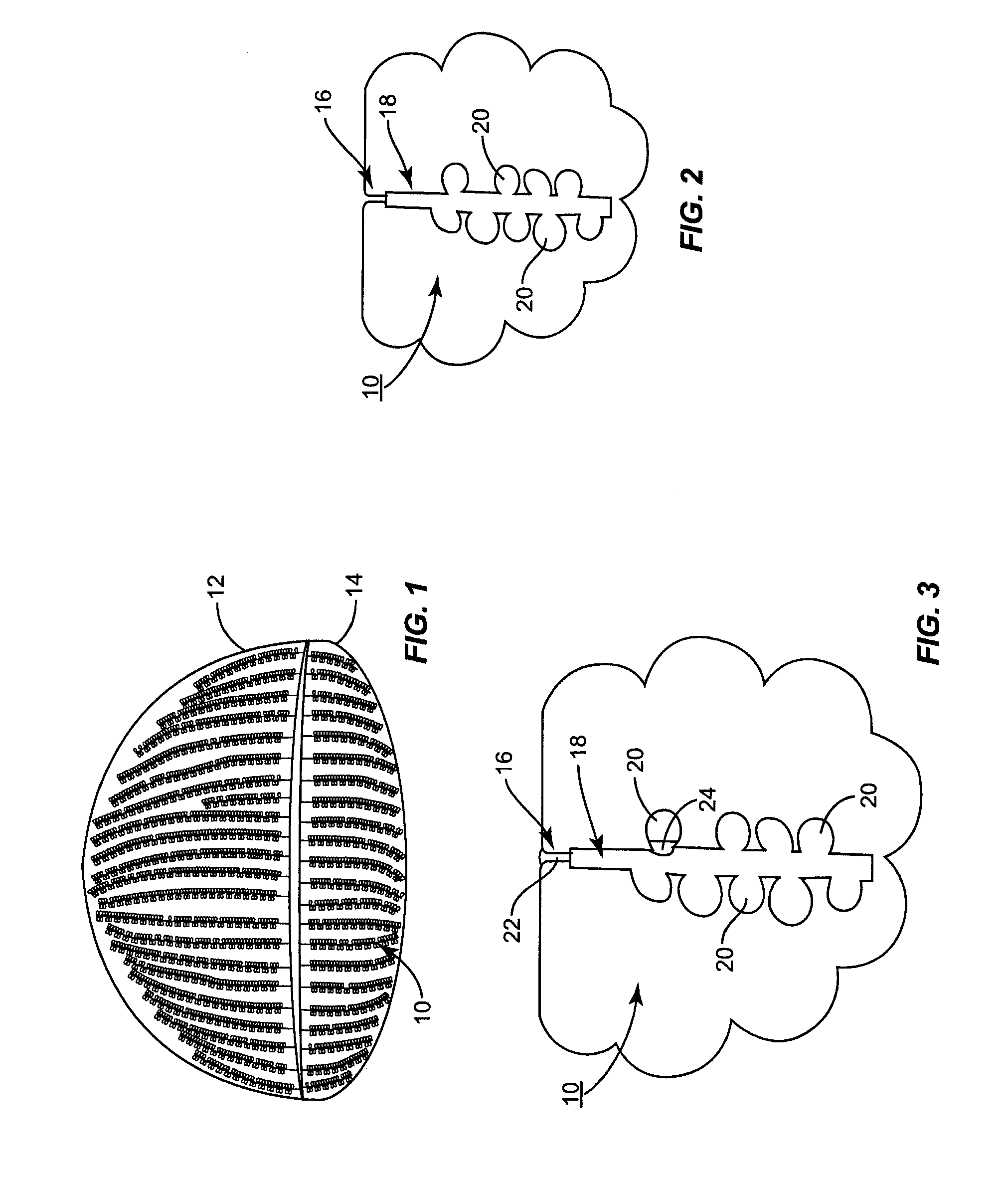 Apparatus for inner eyelid treatment of meibomian gland dysfunction