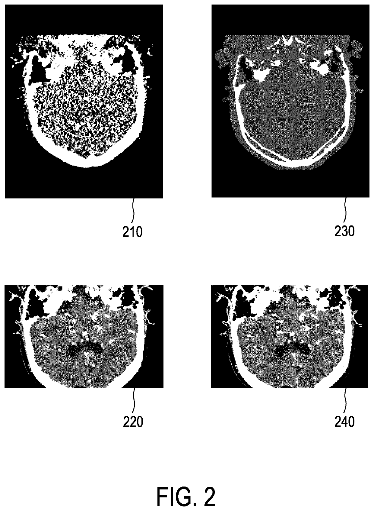 System for reconstructing an image of an object