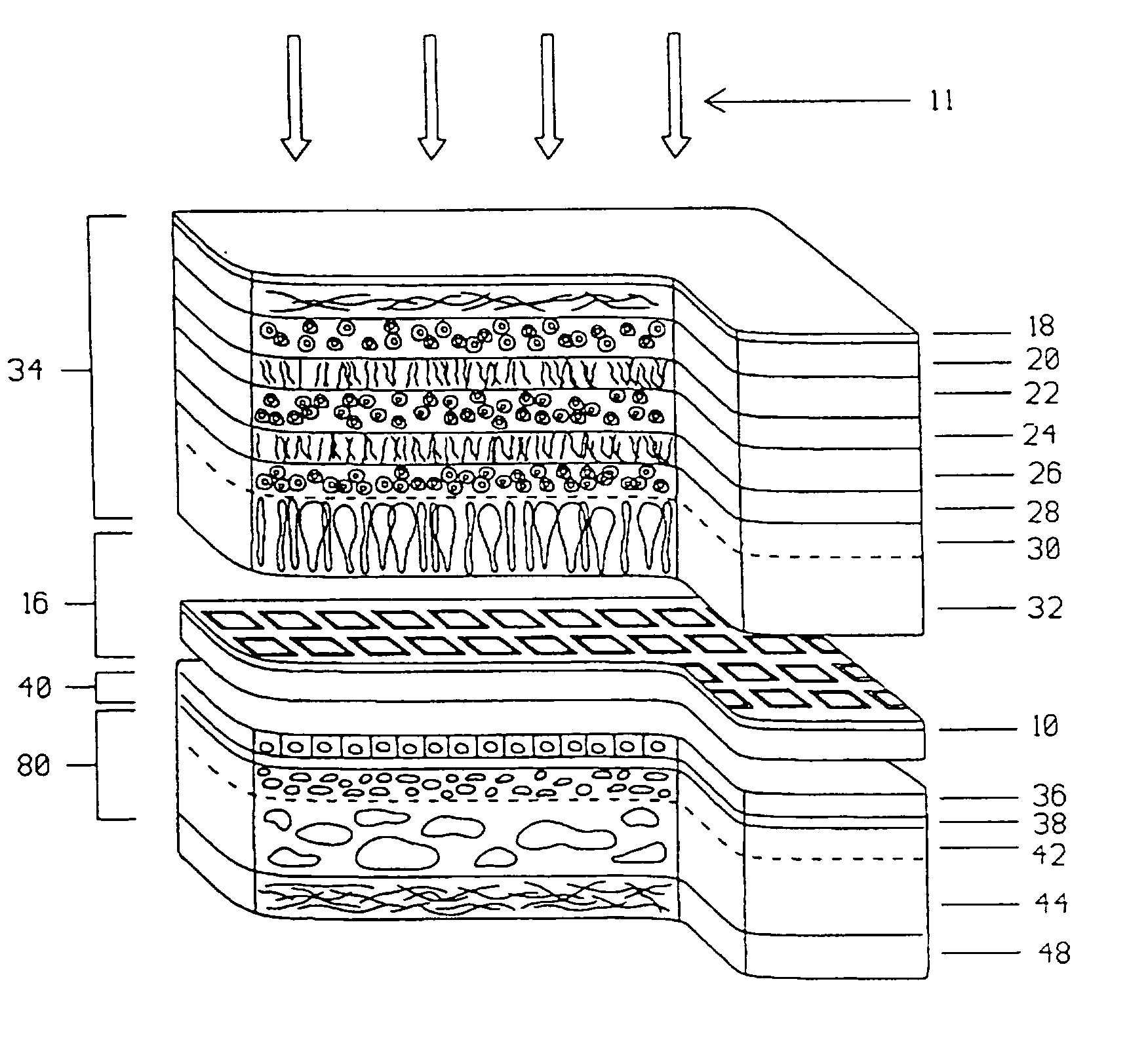 Multi-phasic microphotodetector retinal implant with variable voltage and current capability and apparatus for insertion