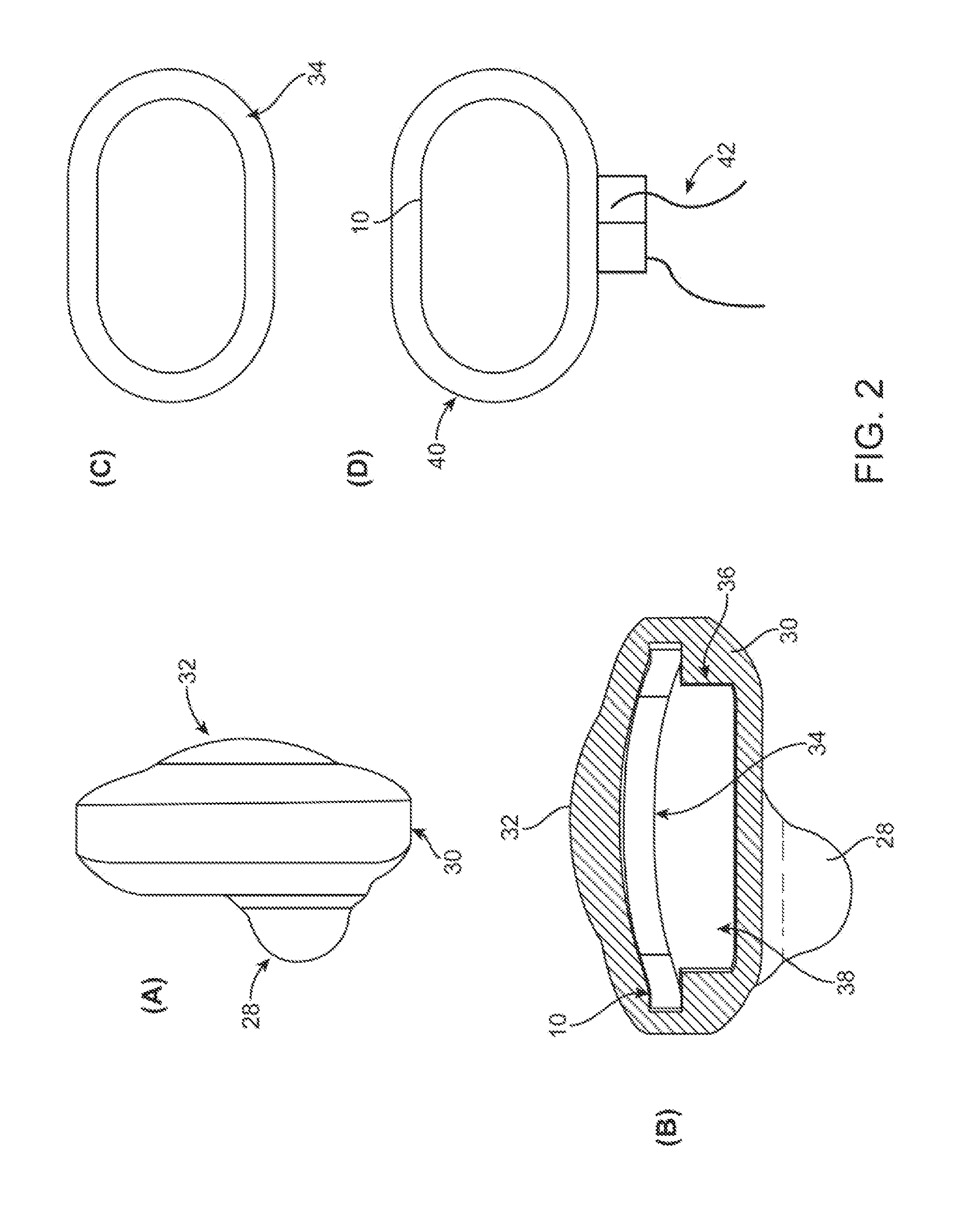 Intra-oral tissue conduction microphone