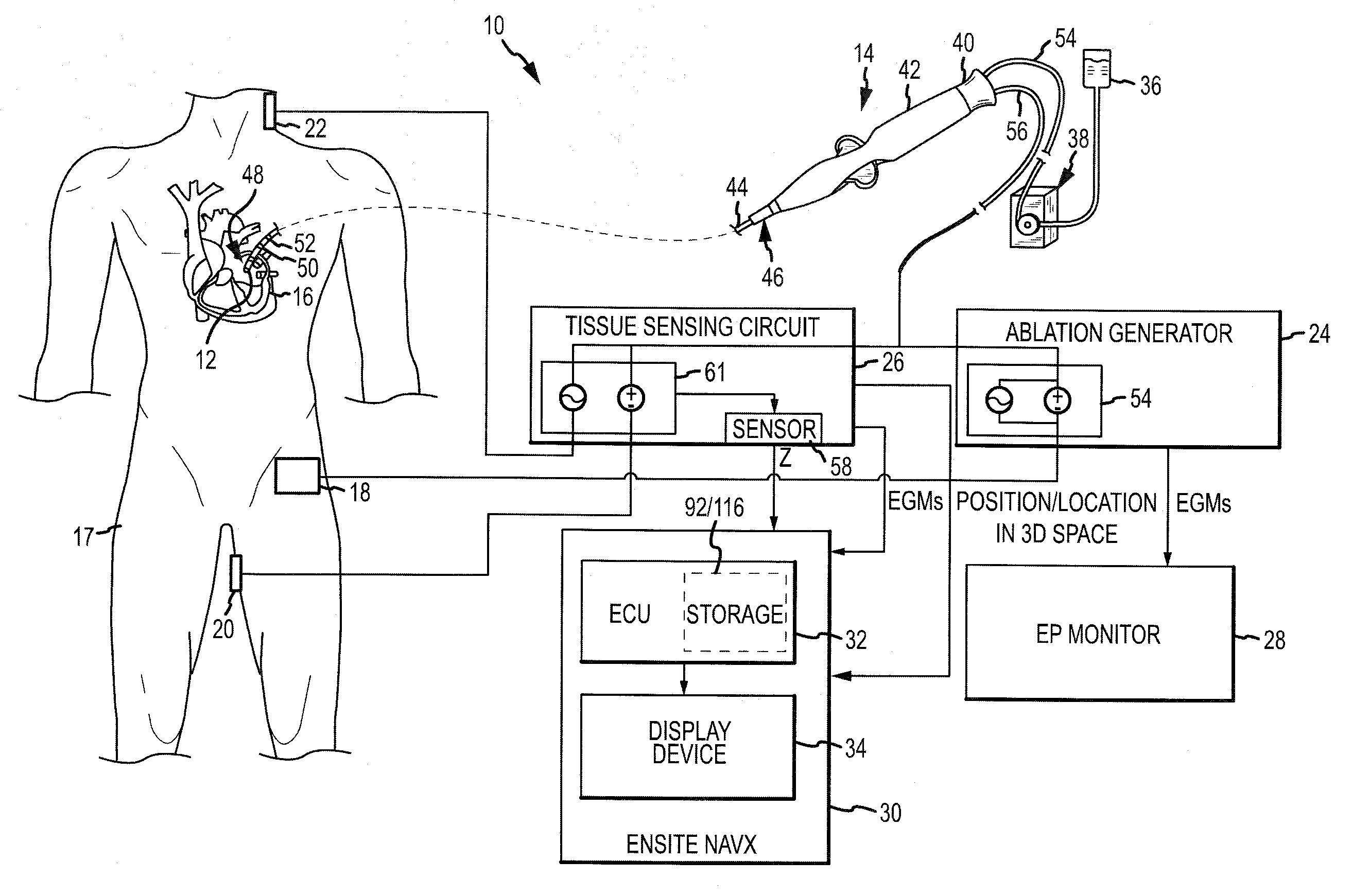 System and method for assessing the proximity of an electrode to tissue in a body