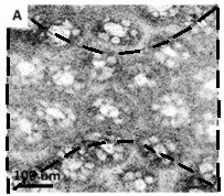 An image correction method for high-resolution optical coherence confocal microscopy