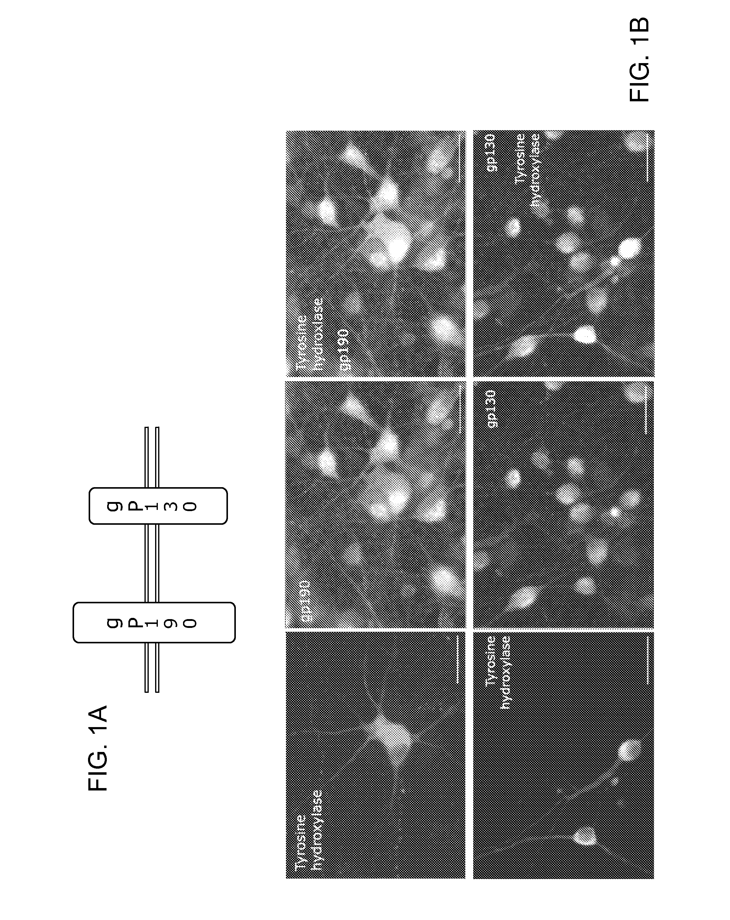 Neurotherapeutic Nanoparticle Compositions and Devices