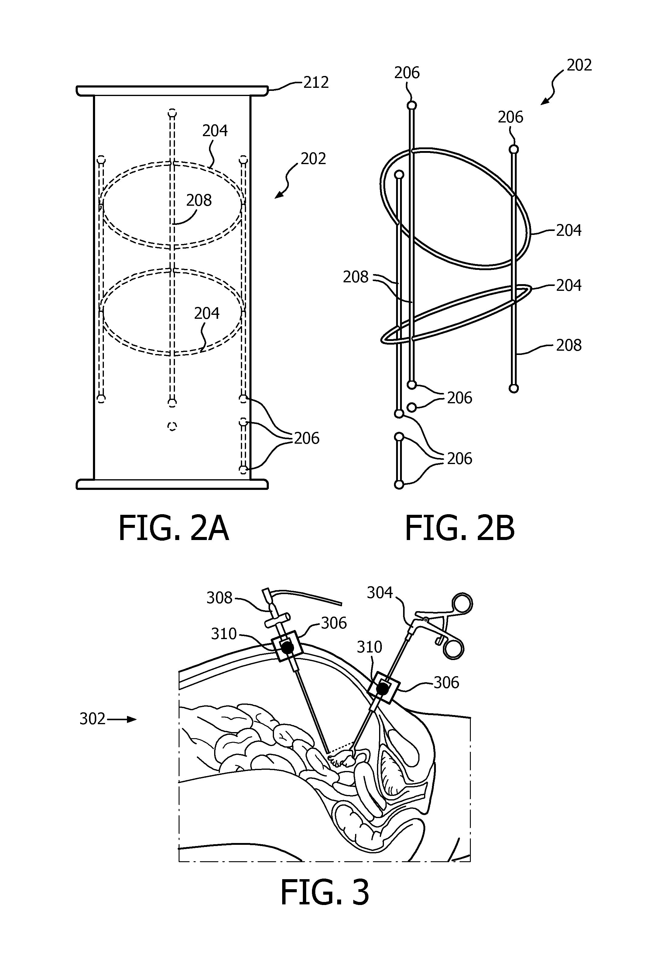 Localization of robotic remote center of motion point using custom trocar