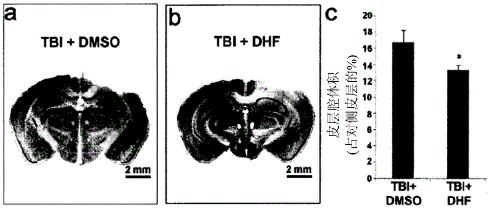 Compositions and methods of treating and preventing neuronal damage from traumatic brain injury