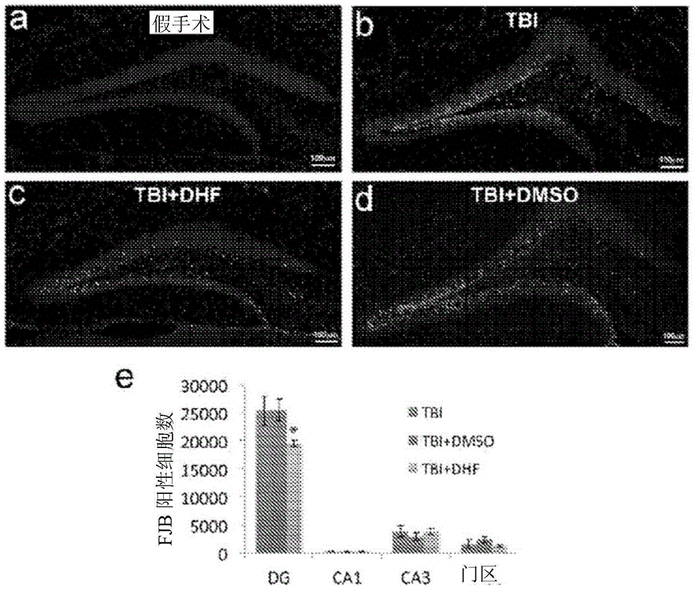 Compositions and methods of treating and preventing neuronal damage from traumatic brain injury