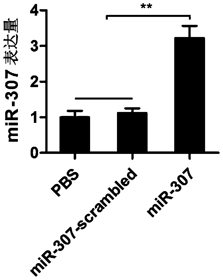 Application of antisense nucleic acid AMO-miR-307 to preparation of preparation for resisting white spot syndrome viruses