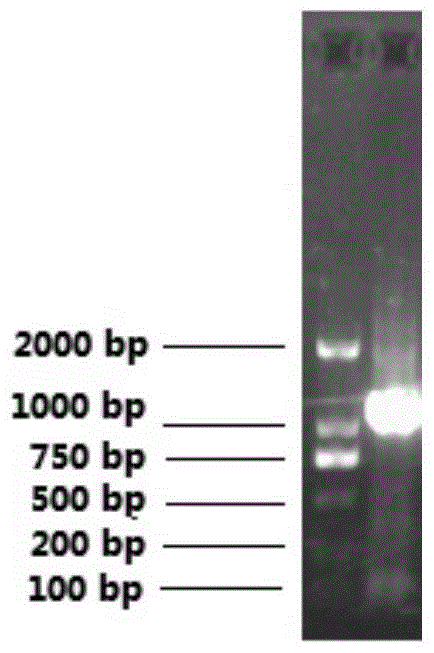 Application of lentivirus-mediated CXCR7 high expression engineered endothelial progenitor cell in treatment of ischemic diseases