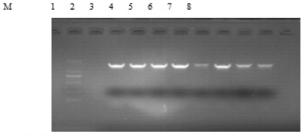 Application of lentivirus-mediated CXCR7 high expression engineered endothelial progenitor cell in treatment of ischemic diseases