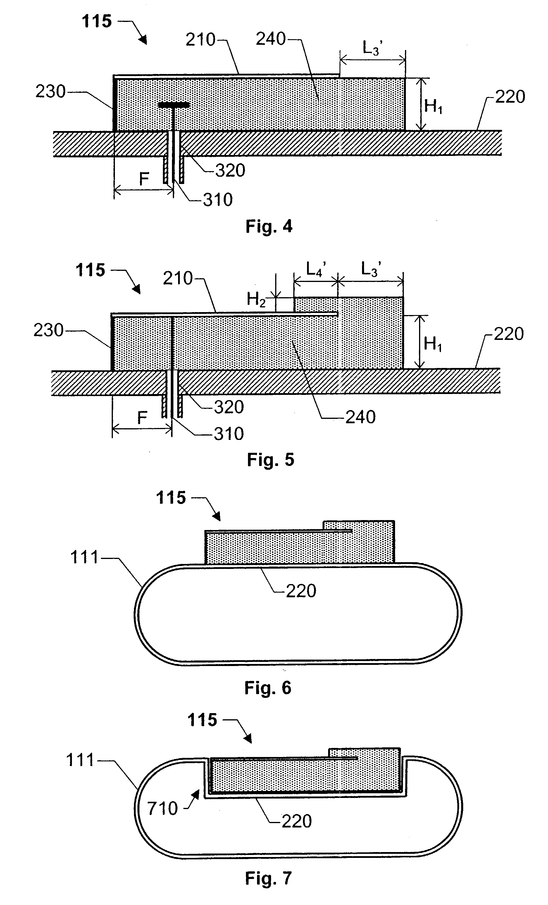 Implantable antenna for use with an implantable medical device