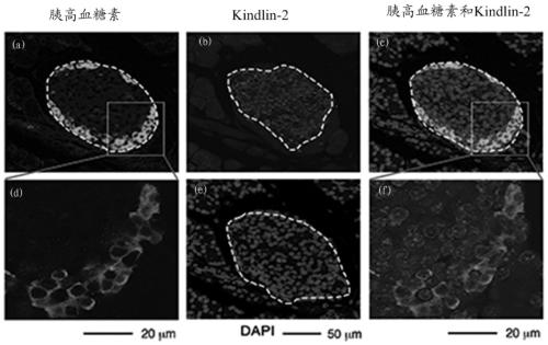 Application of kindlin-2 protein as a target in the preparation of drugs for treating diabetes
