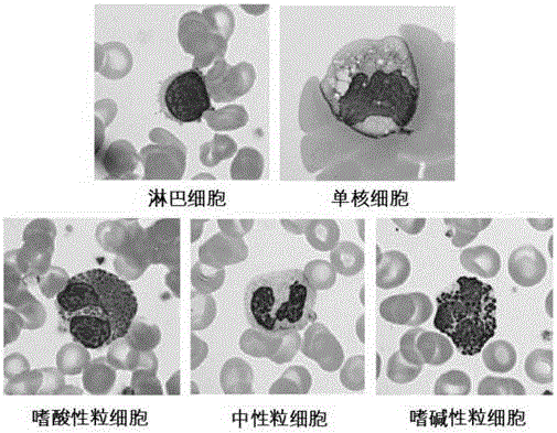 Nucleus segmentation method based on white blood cell detection