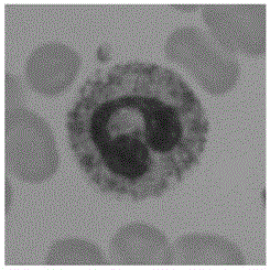 Nucleus segmentation method based on white blood cell detection