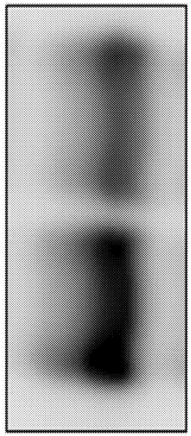 Systems and methods for diagnosing and treating chronic organ rejection