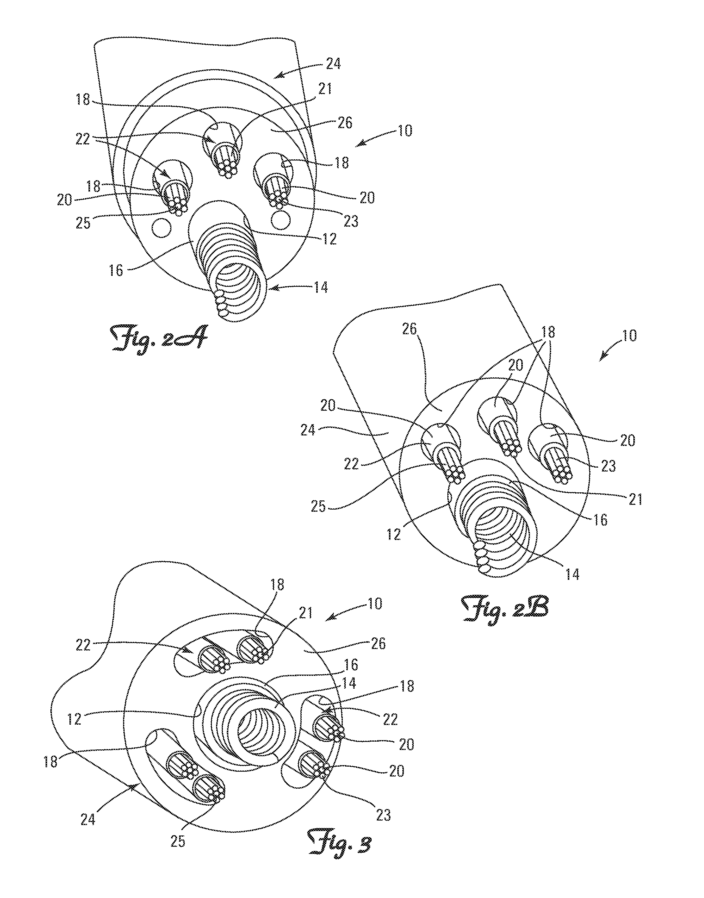 Methods and Apparatus for Detecting and Localizing Partial Conductor Failures of Implantable Device Leads