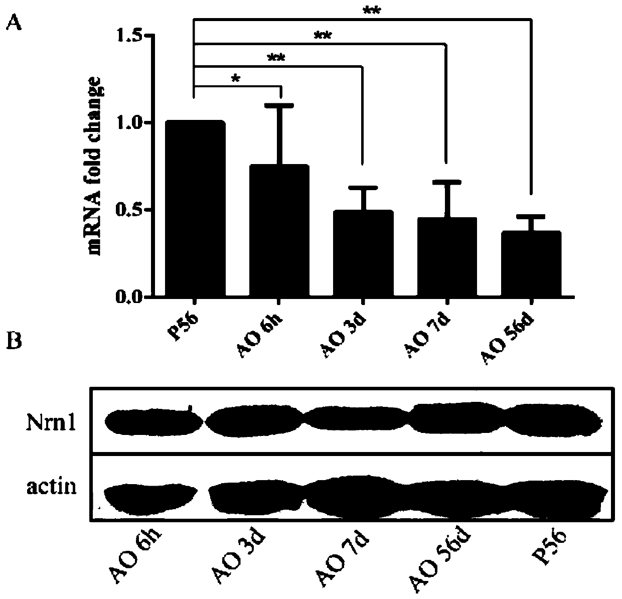 Application of recombinant human neurite-promoting factor Neuritin and medicine for treating auditory neuropathy