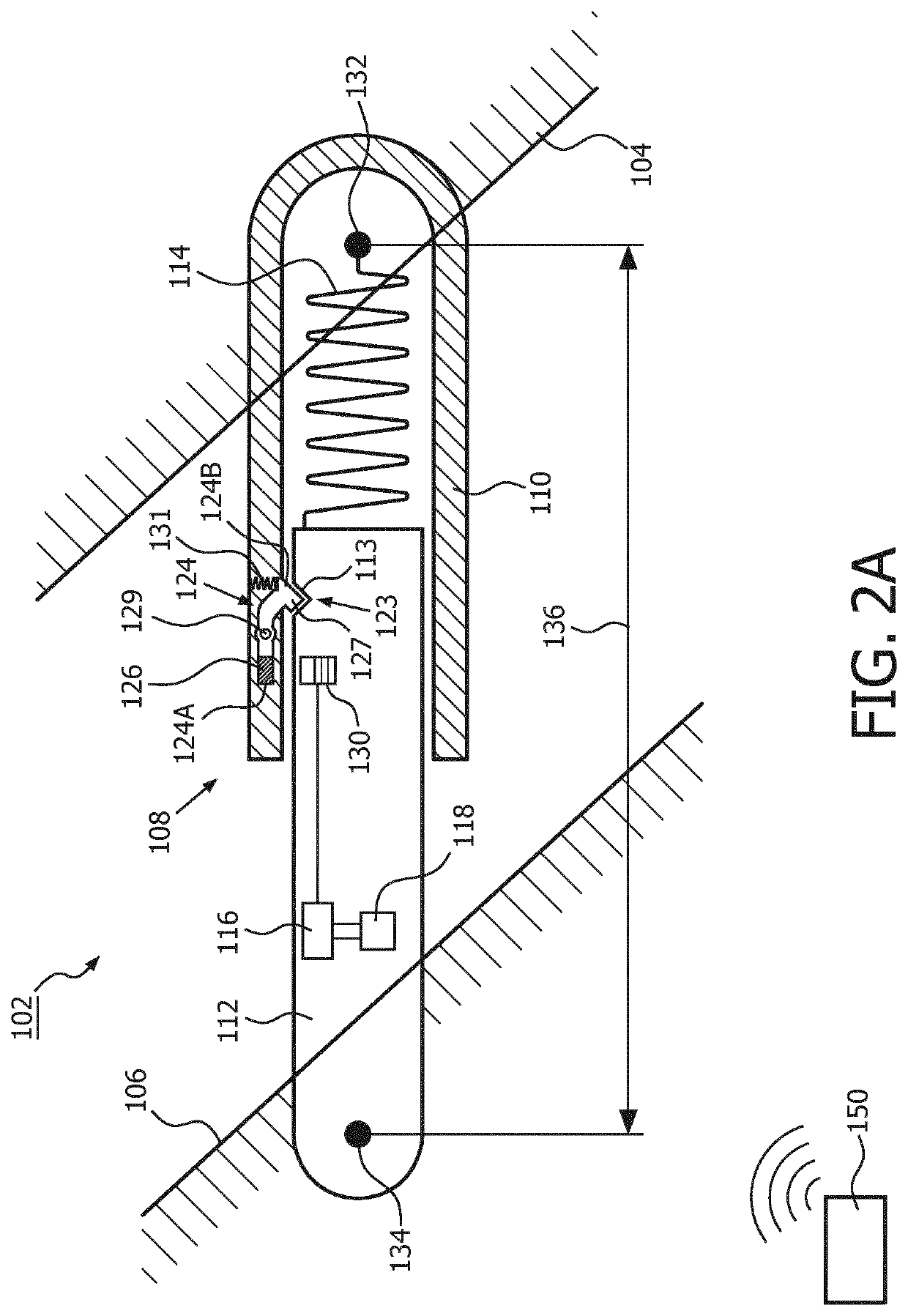 Mandibular advancement device and method of adjusting a dimension of a coupling assembly of a mandibular advancement device
