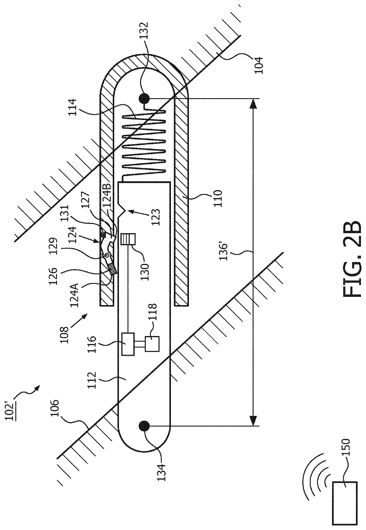 Mandibular advancement device and method of adjusting a dimension of a coupling assembly of a mandibular advancement device