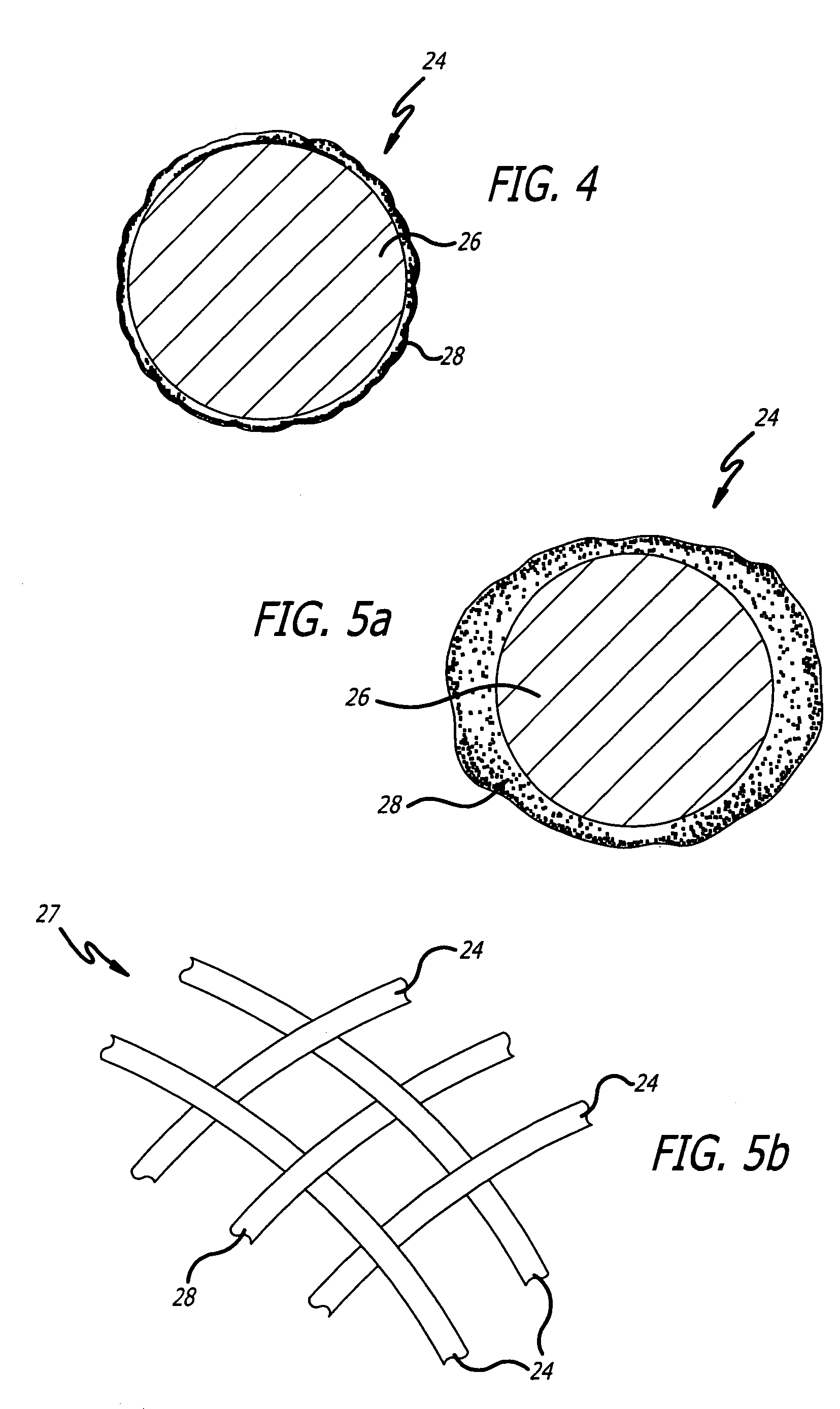 Aneurysm treatment device and method of use