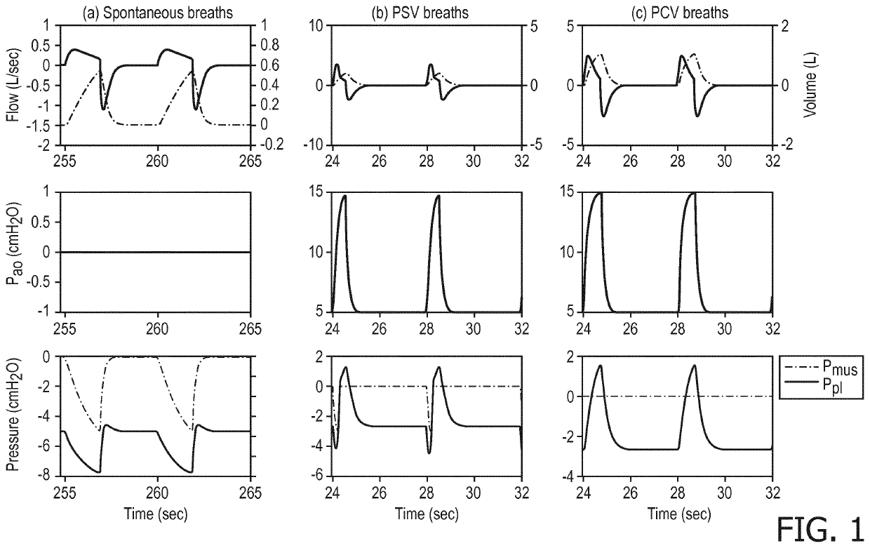 Enhancement of respiratory parameter estimation and asynchrony detection algorithms via the use of centeral venous pressure manometry
