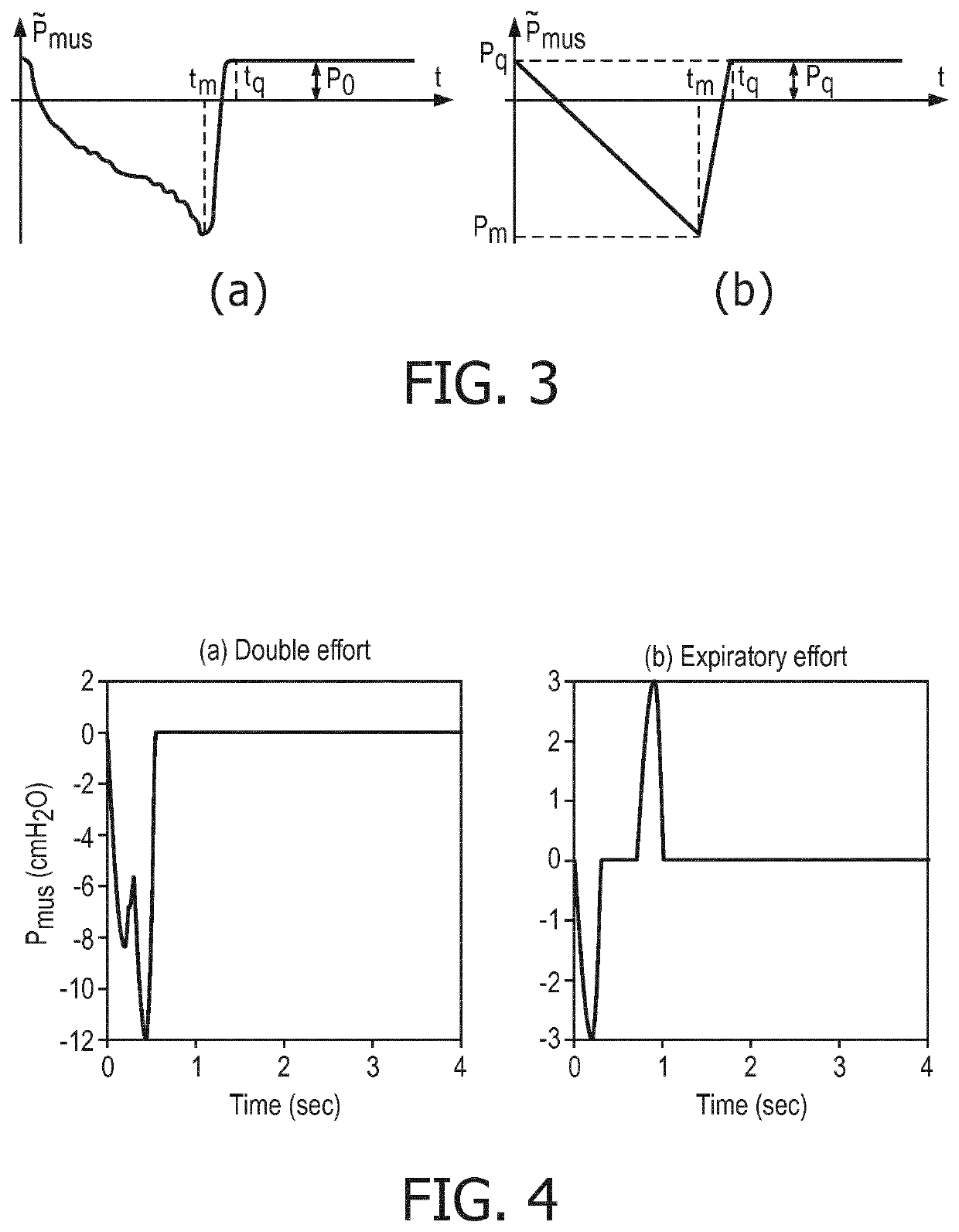 Enhancement of respiratory parameter estimation and asynchrony detection algorithms via the use of centeral venous pressure manometry