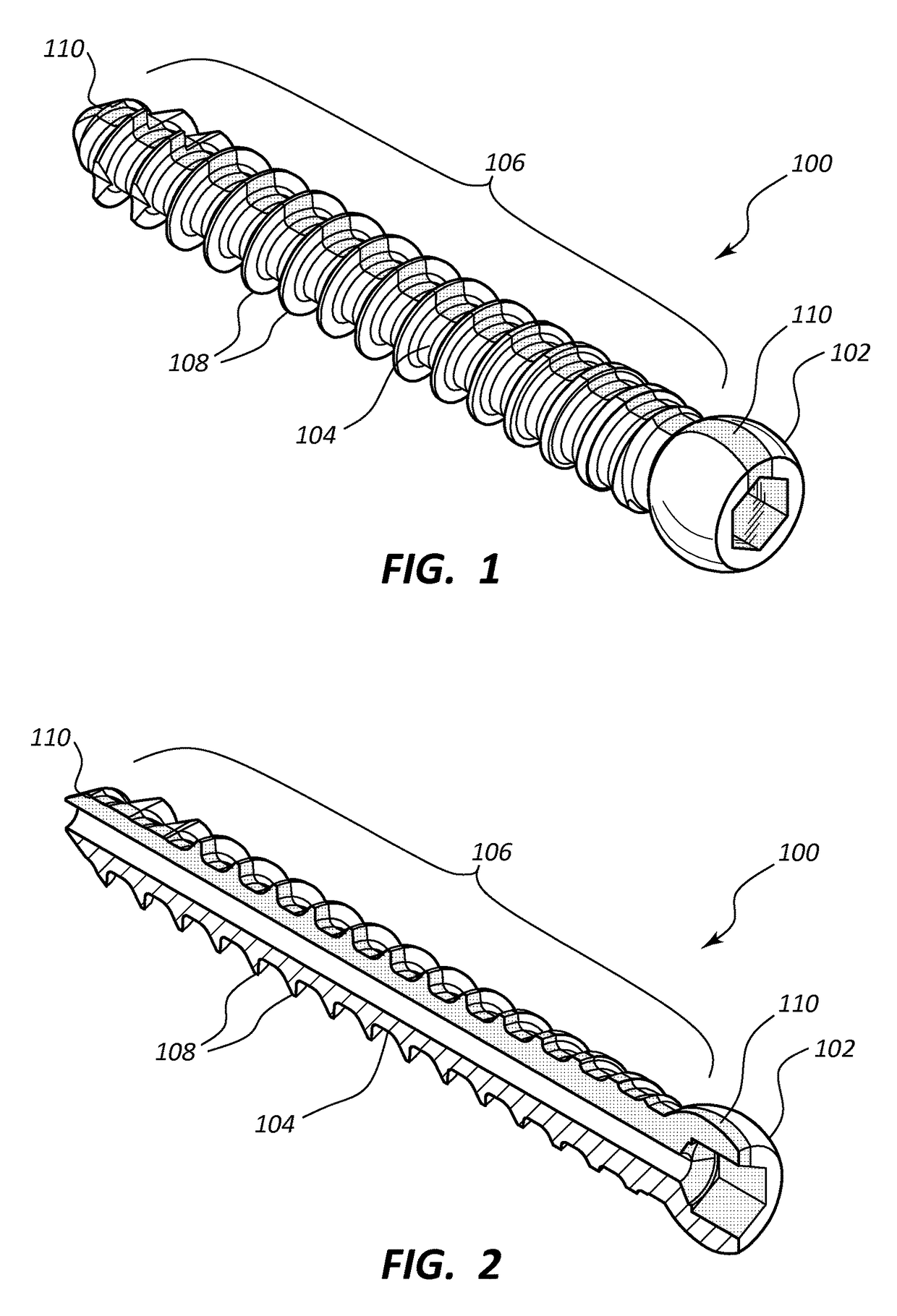 Pedicle screw with electro-conductive coating or portion