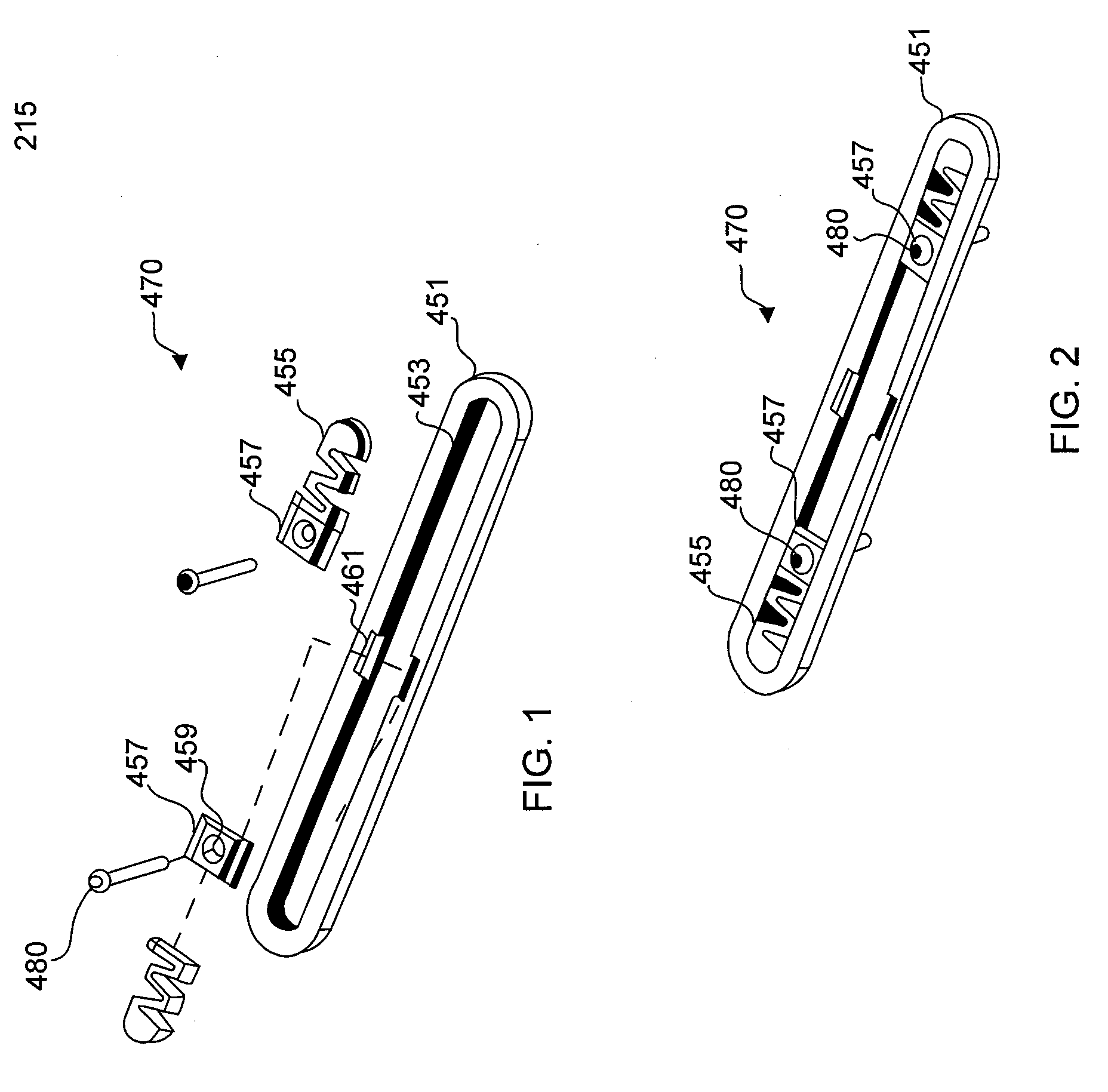 Bone screw system and method for the fixation of bone fractures