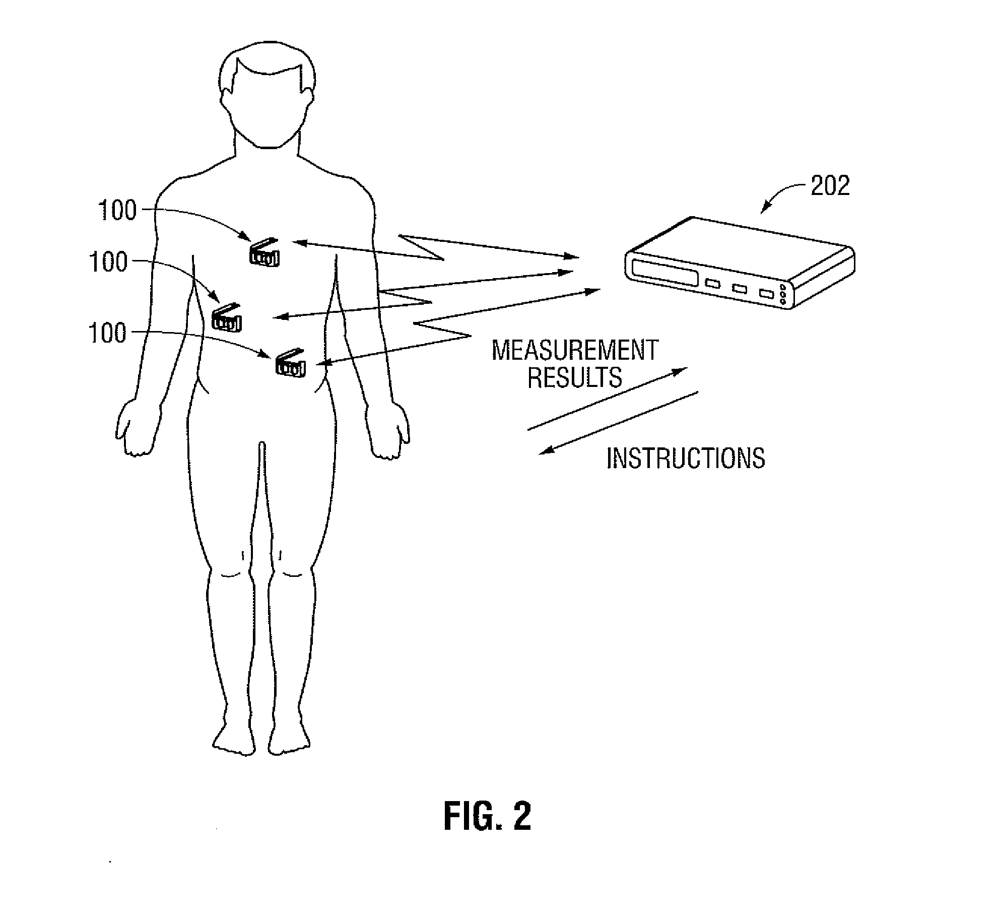 Stand Alone Energy-Based Tissue Clips