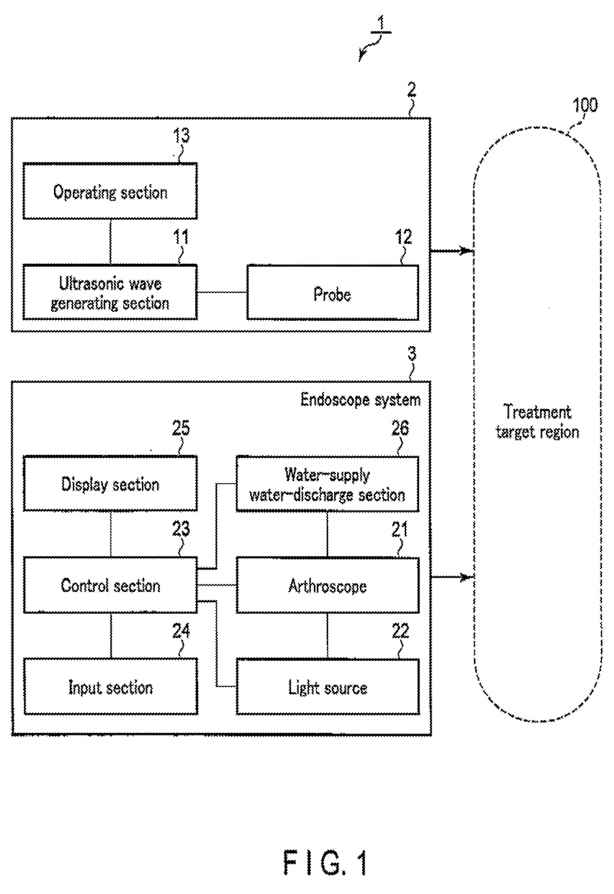 Arthroscopic surgery method for ankle ligament reconstruction