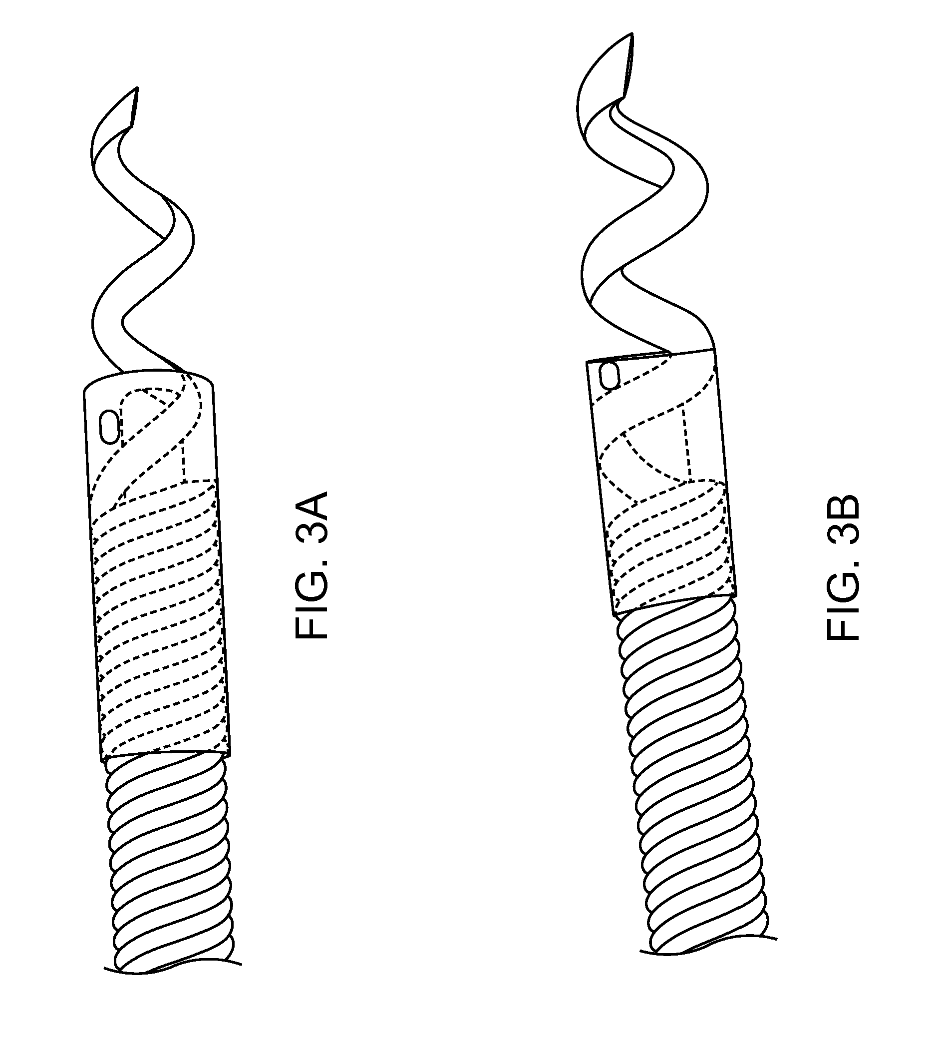 Radial and trans-endocardial delivery catheter