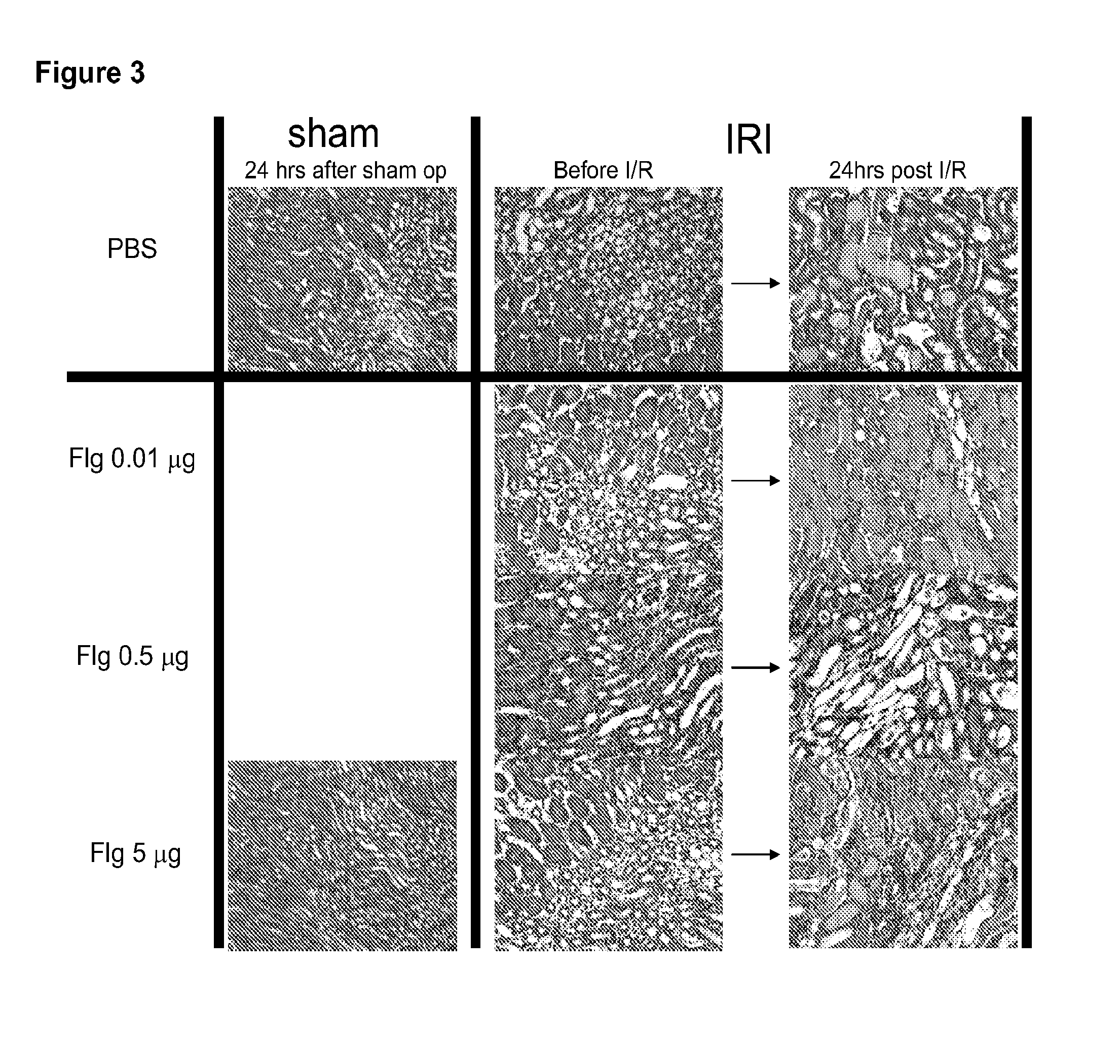 Methods for treating reperfusion injuries using flagellin