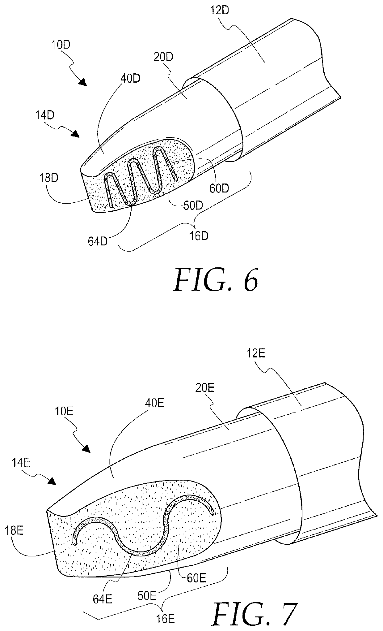 Surgical instrument and method for goniotomy procedure