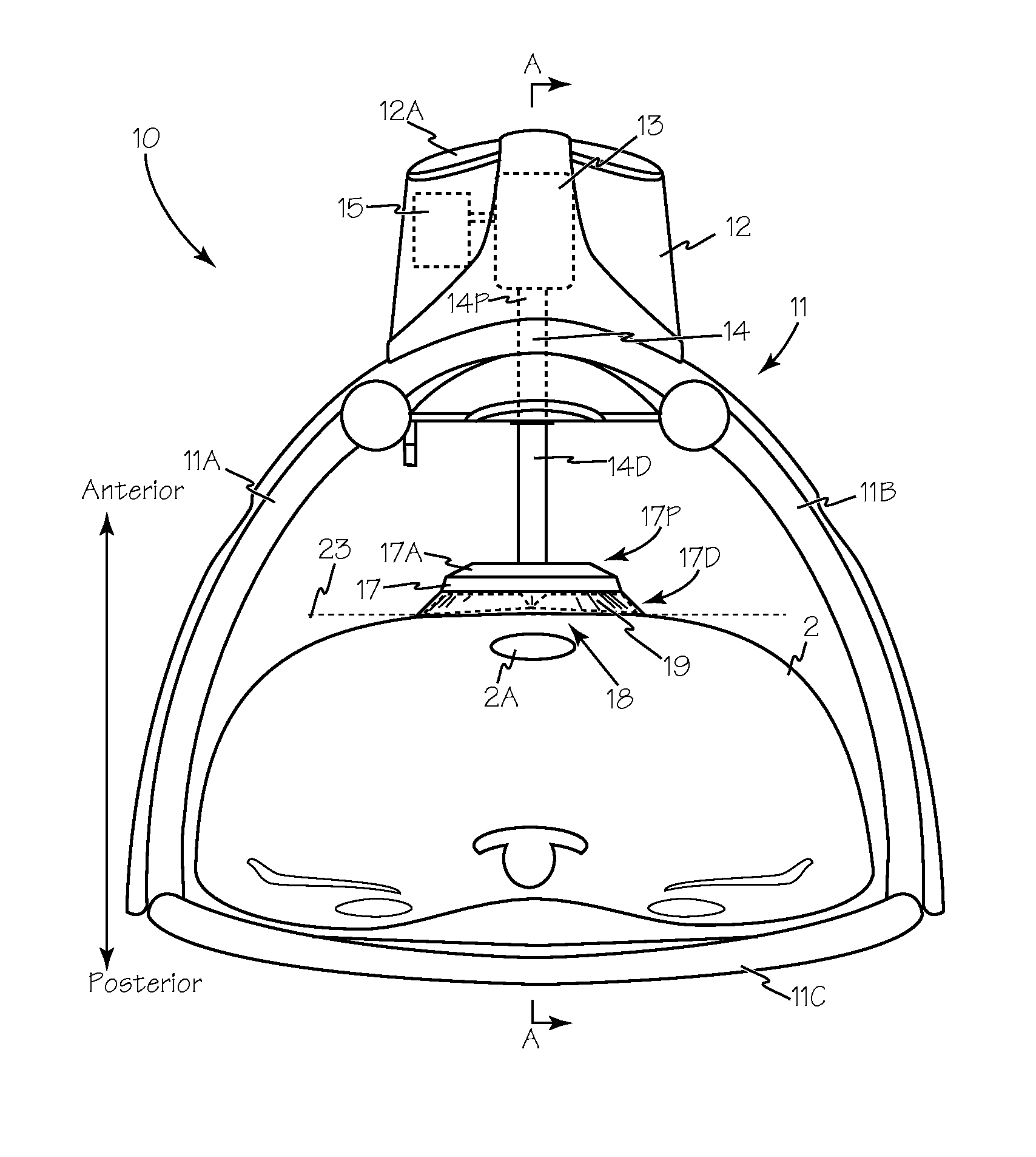 Method and Device for Performing Alternating Chest Compression and Decompression