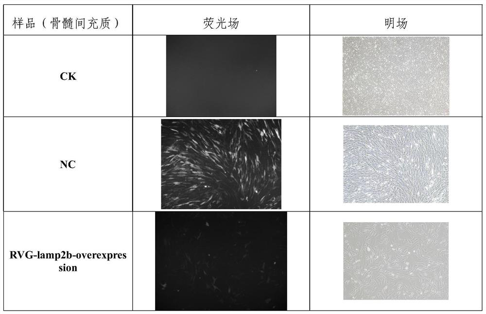 Application of miR-486-3p to preparation of product for treating neuroinflammation caused by SAH