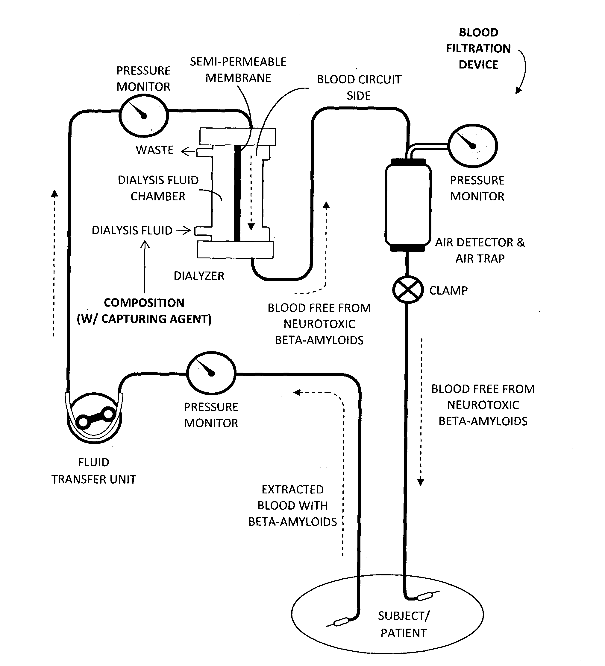 Novel Composition for Extracorporeal Reduction of Beta-Amyloids and Process for Producing Thereof