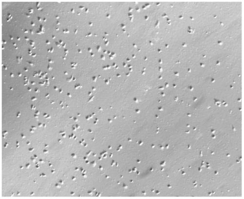 A tumor-specific target and its application in the preparation of cellular immunotherapy preparations