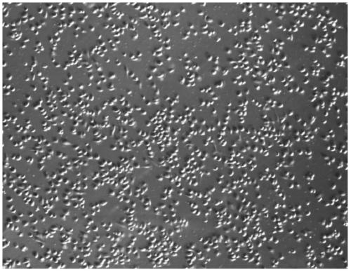 A tumor-specific target and its application in the preparation of cellular immunotherapy preparations