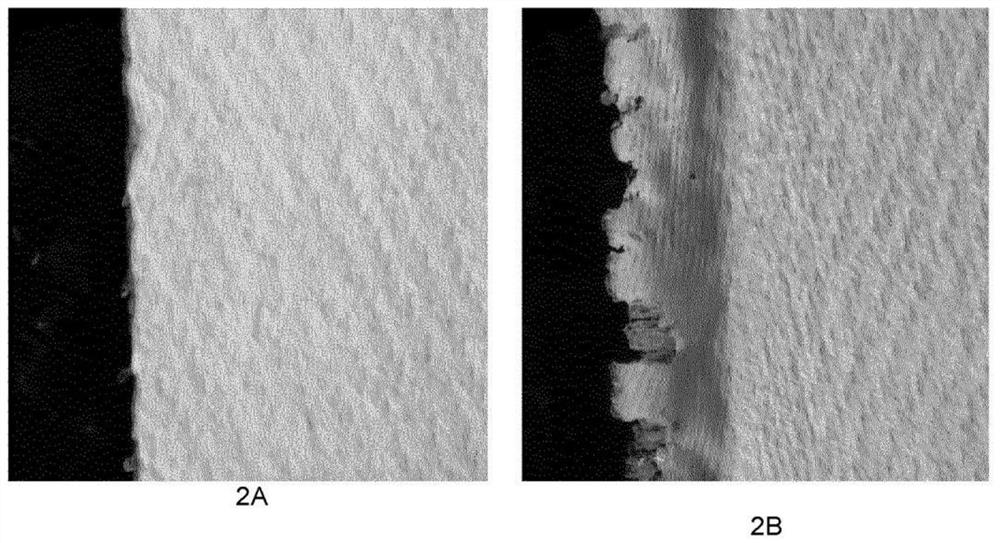 Medical implant component comprising composite biotextile and method of making