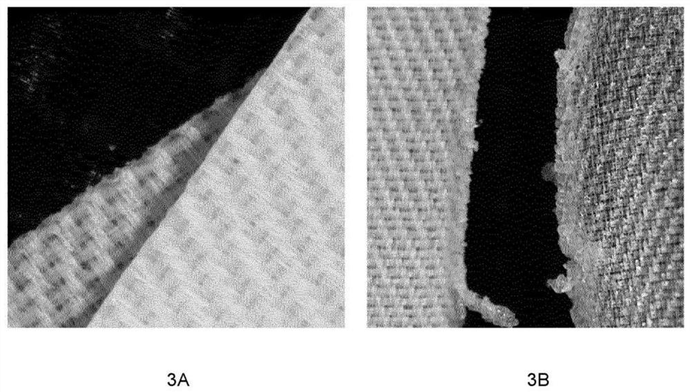 Medical implant component comprising composite biotextile and method of making