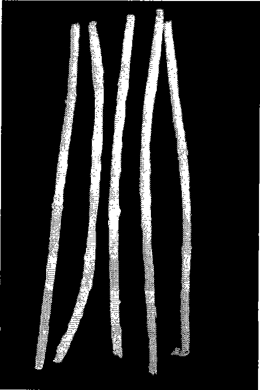 Ureteric branches support and preparation method thereof