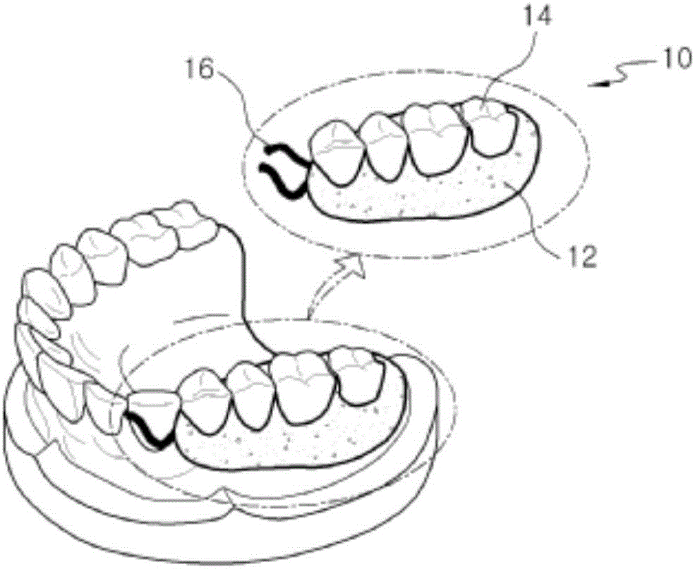 Partial denture and method for manufacturing same