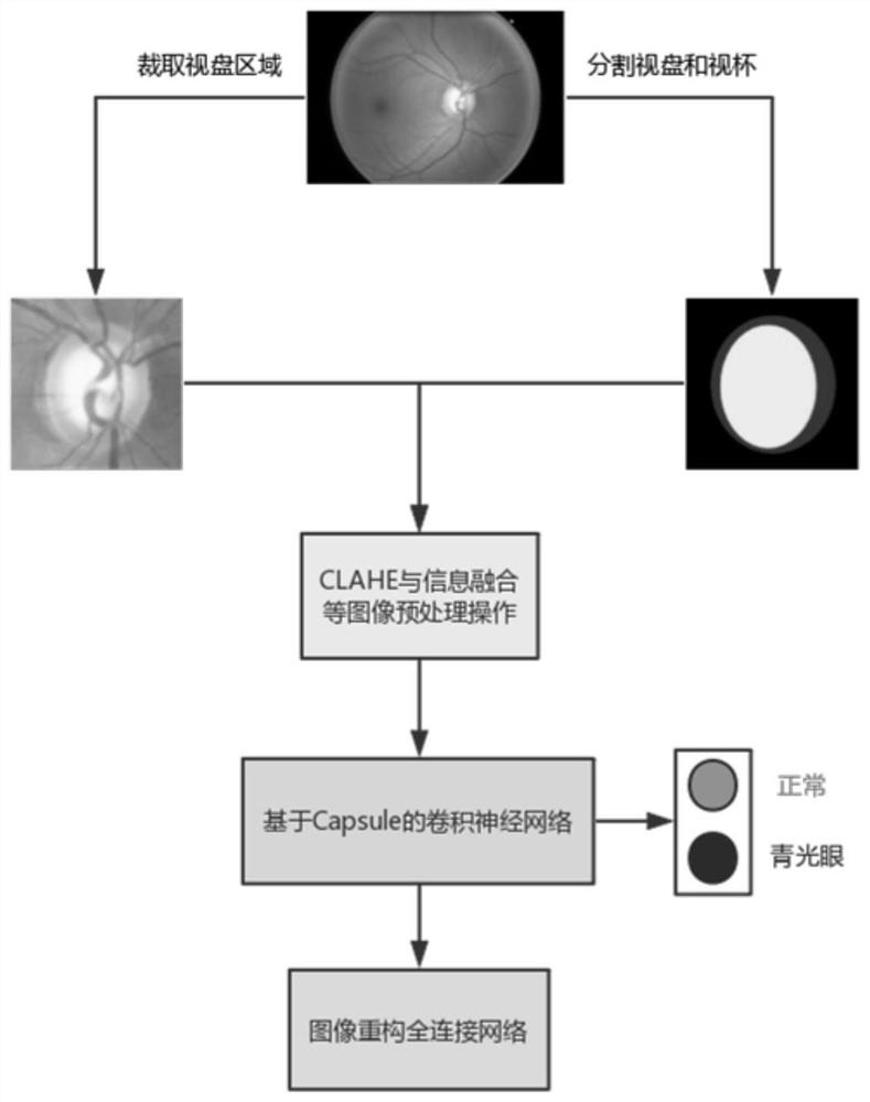 A glaucoma medical image classification method based on capsule theory