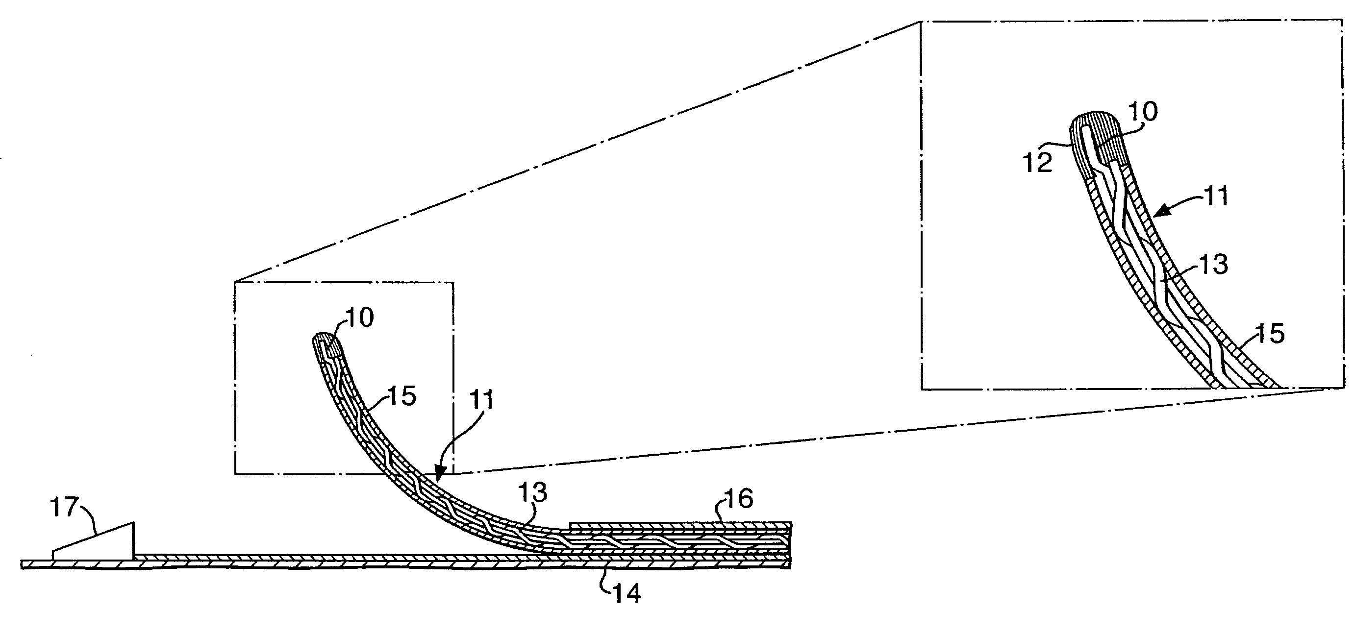 Catheter positioning device