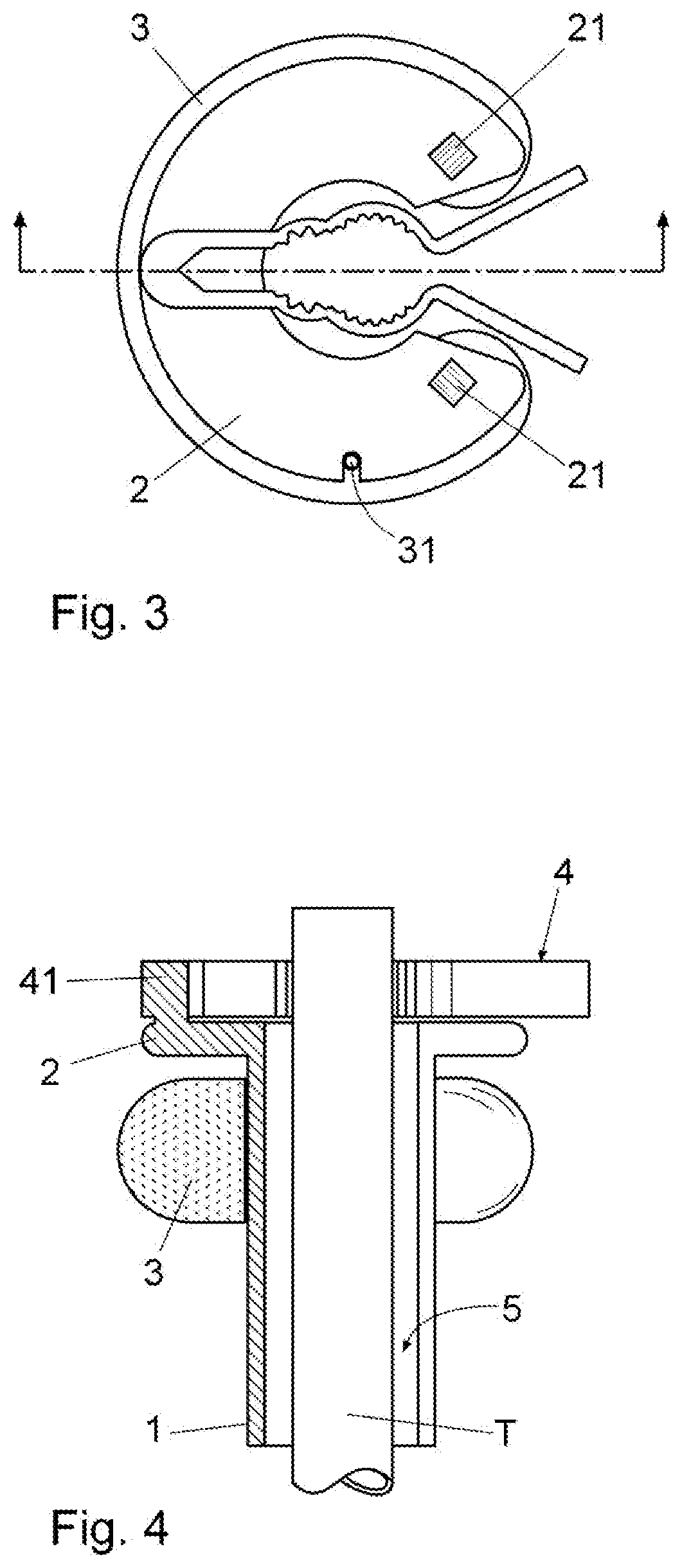 A device for holding endotracheal tubes