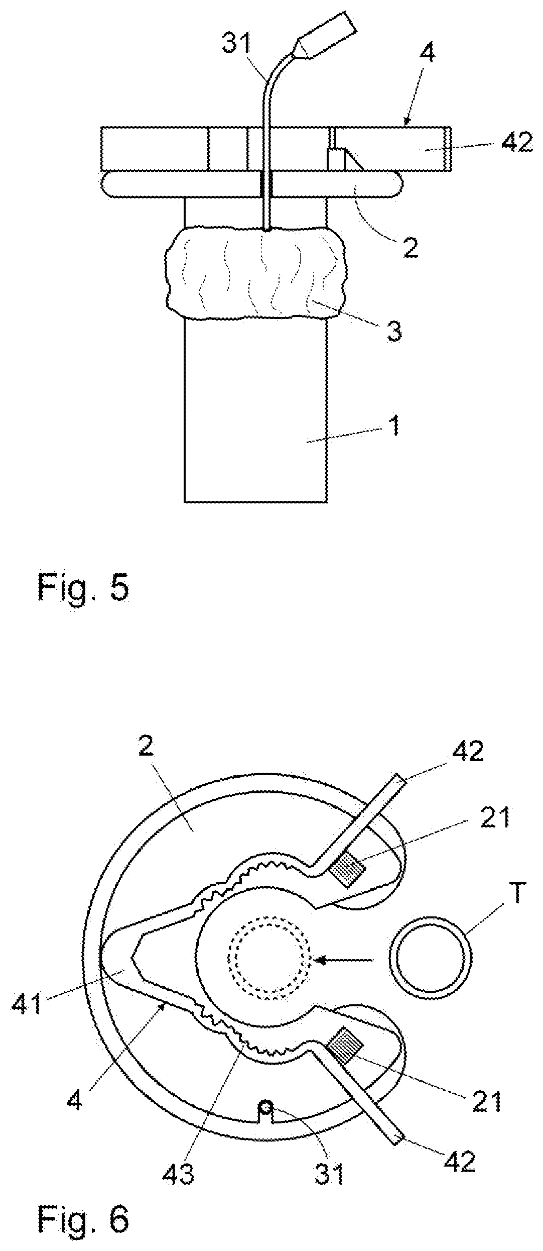 A device for holding endotracheal tubes