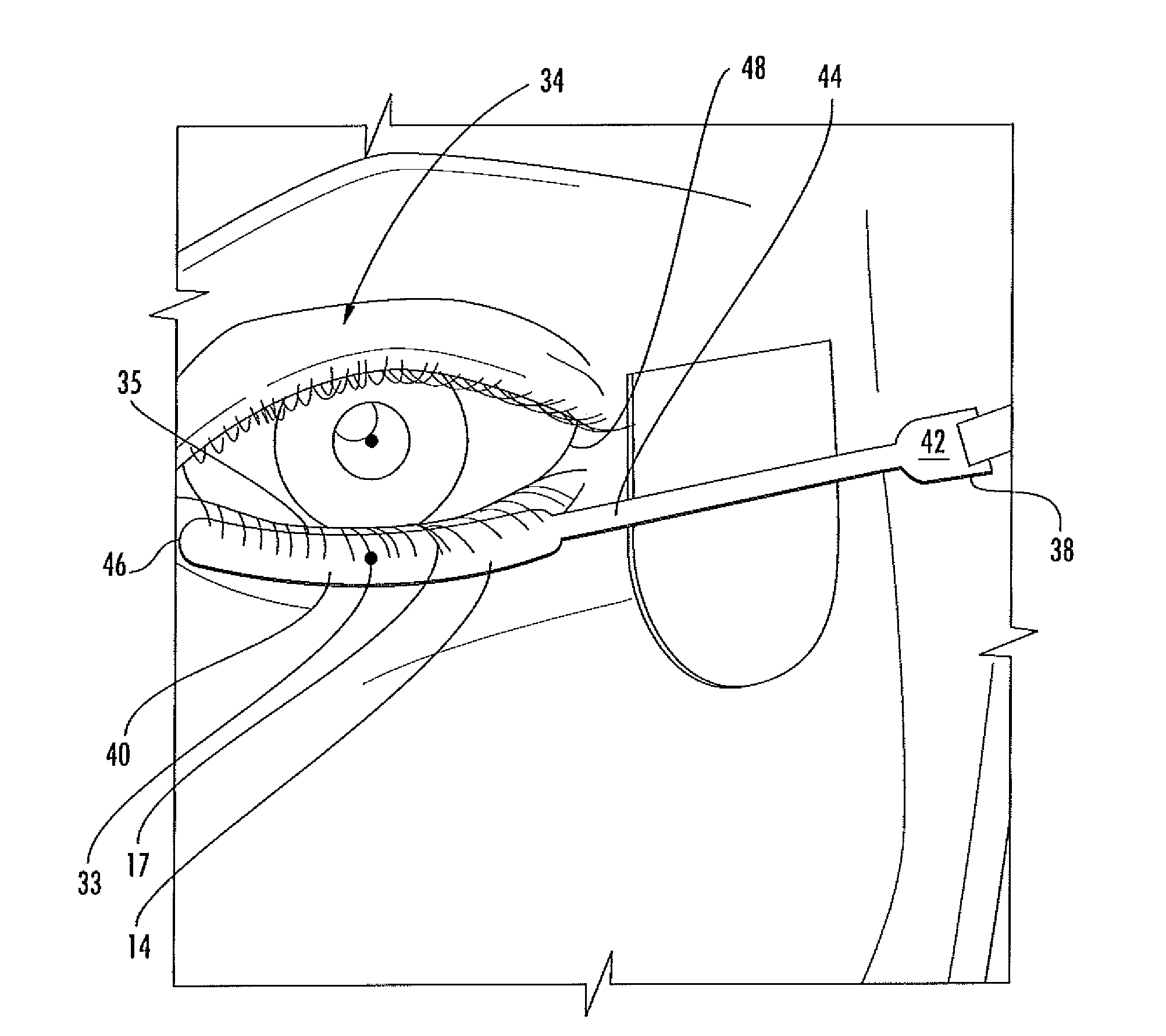 Electrode sensor assembly for electroretinography and pattern electroretinography