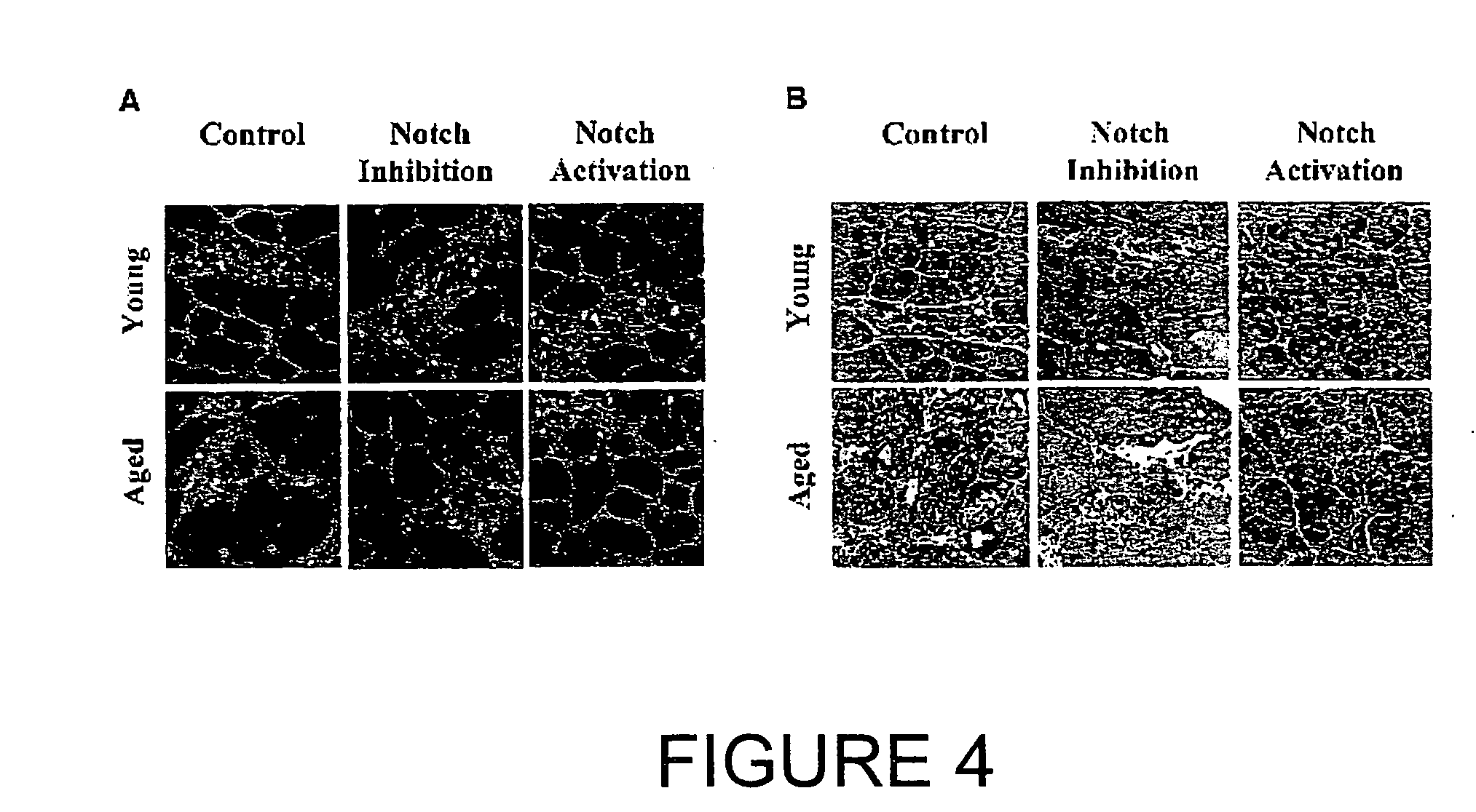 Methods and compositions for regeneration of aged tissues